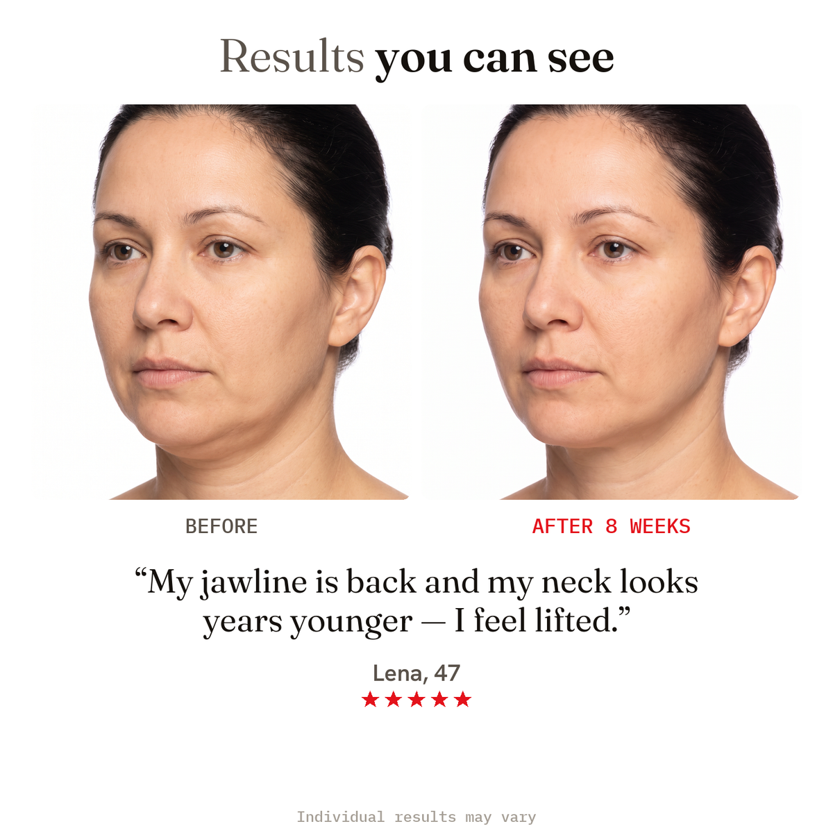 Results you can see — neck before and after in 8 weeks