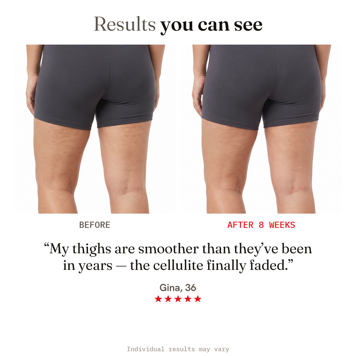 Results you can see — thigh before and after in 8 weeks