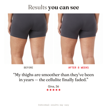 Results you can see — thigh before and after in 8 weeks